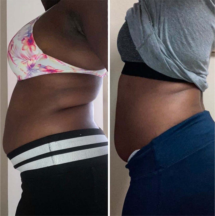 User displaying weight reduction results through side-by-side comparison photos.