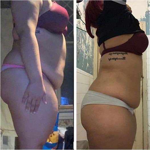 Woman showing before and after body transformation using Flat Tummy Co. products.