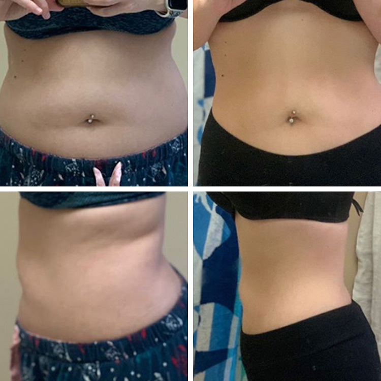 Shanan's results after using Flat Tummy Lollipops