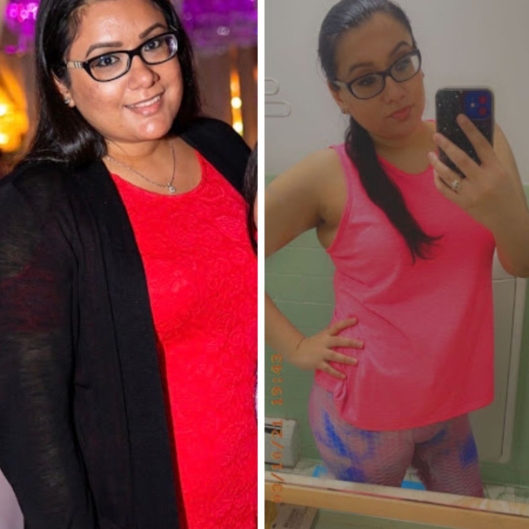 before &amp; after weight loss