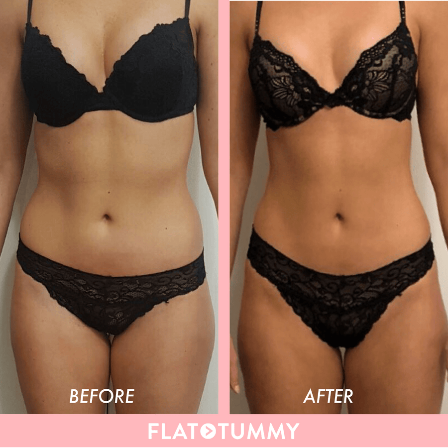 Flat Tummy Before After