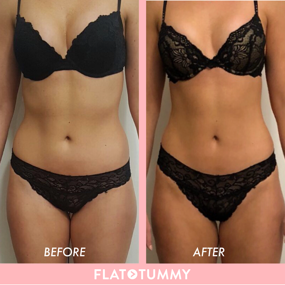 Flat Tummy Before and After