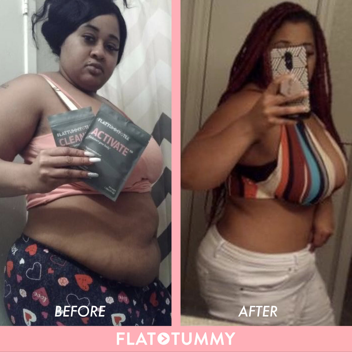 flat tummy ultimate bundle before and after picture