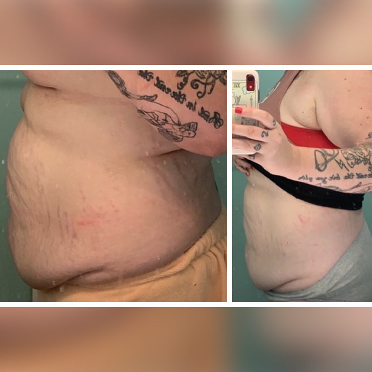 Lorrie's results after using Flat Tummy Cleanse